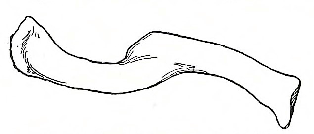 Healed fracture of clavicle from proto-phase A-Group graves in Cemetery 17. Male in grave 24. No scale. Drawing from Elliot Smith and Wood Jones (1910: figure 74).