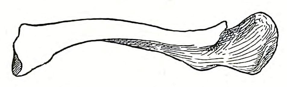 Healed fracture of clavicle from proto-phase A-Group graves in Cemetery 17. Male in grave 29. No scale. Drawing from Elliot Smith and Wood Jones (1910: figure 75).