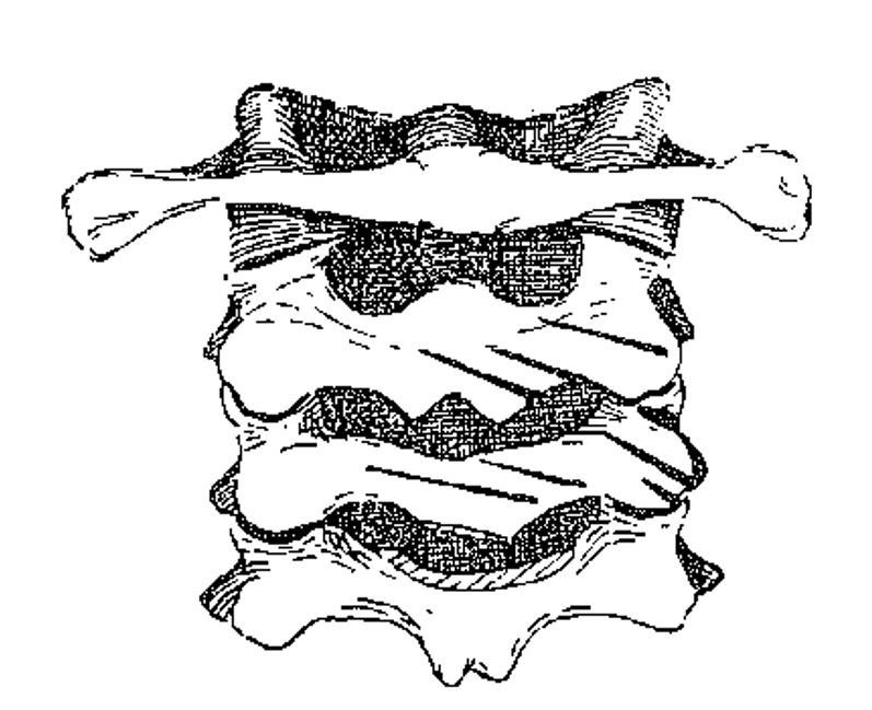 The male in grave 211 in Cemetery 45 had seven cut marks on his third and fourth cervical vertebrae. Drawing from Elliot Smith and Wood Jones (1910: fig. 69).